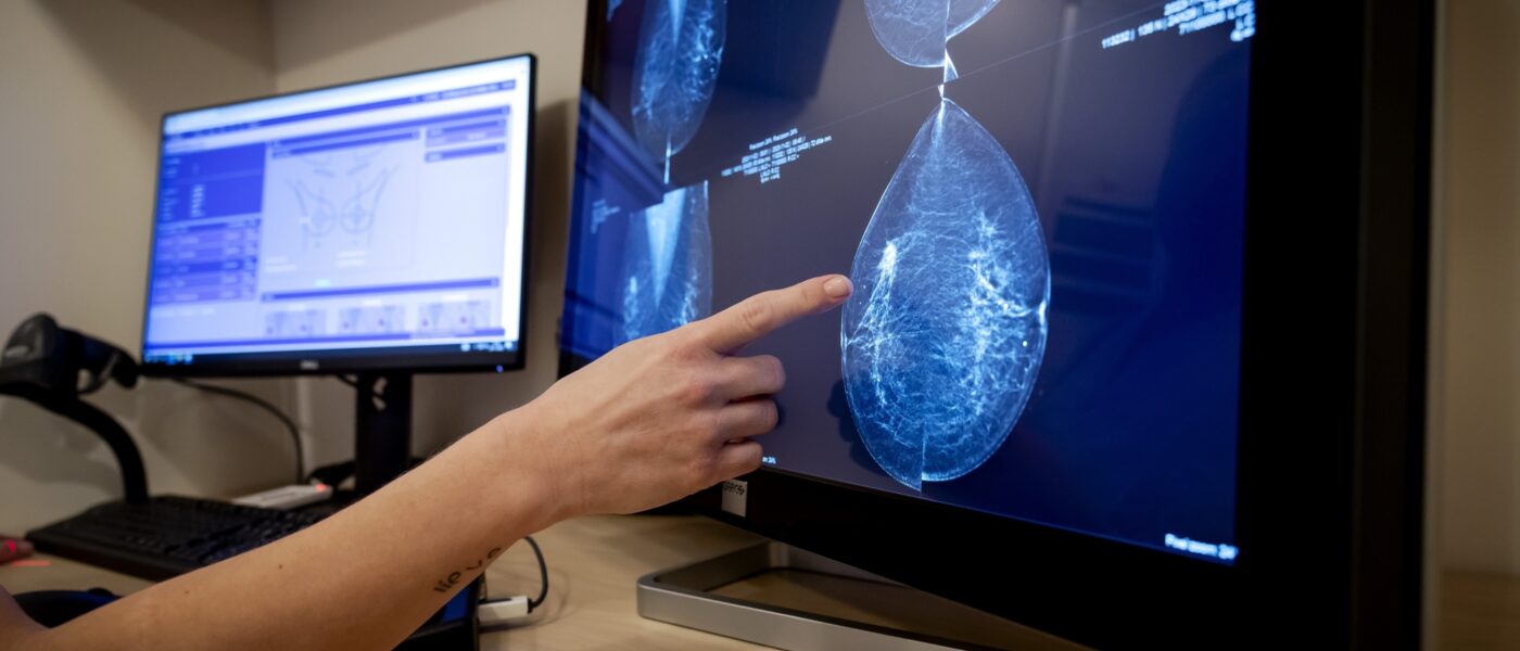 Borstkanker op tijd herkennen met de 'Know Your Lemons' app | NPO Radio 1