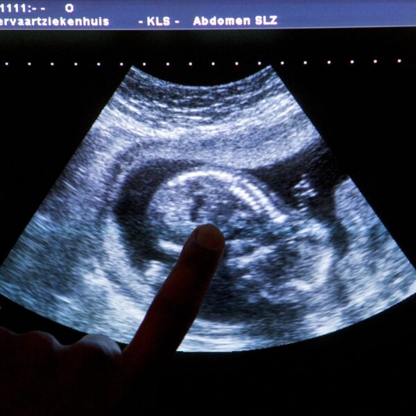 Verloskundigen zien abortus om geslacht van het kind na pretecho