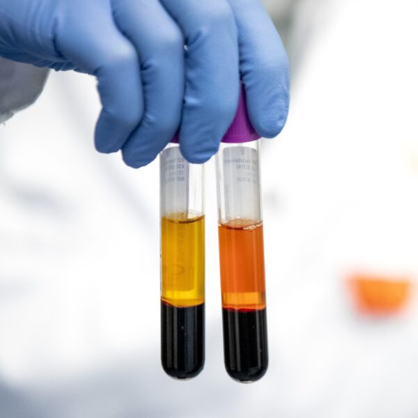 Nieuwe podcast over erfelijke ziekten: 'Meer dan half miljoen Nederlanders hebben er één'