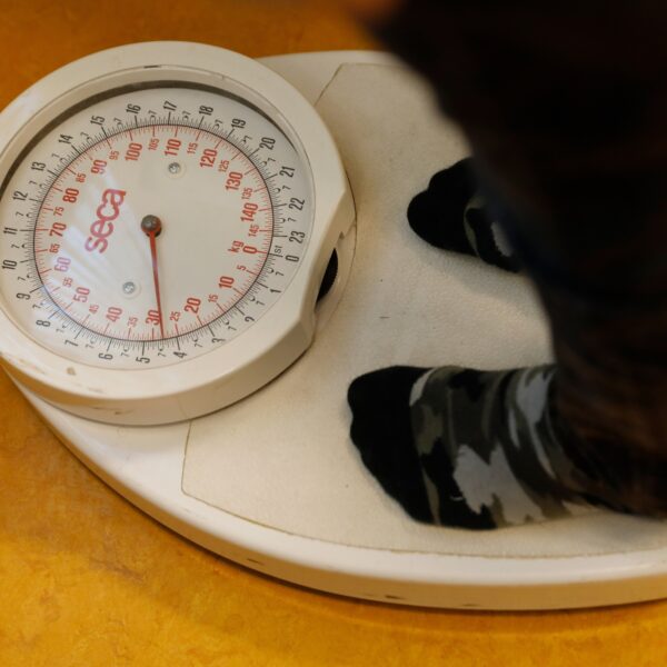 Steeds jongere meisjes hebben anorexia: '10-jarigen zijn geen uitzondering meer'