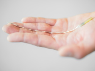 Elektronische implantaten als mogelijk medicijn tegen migraine