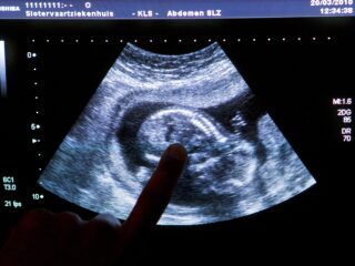 Bijna helft van de werkende of werkzoekende zwangere vrouwen gediscrimineerd: 'Al zolang hardnekkig probleem'