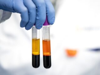 Nieuwe podcast over erfelijke ziekten: 'Meer dan half miljoen Nederlanders hebben er één'