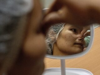 Plastisch chirurgen van over de hele wereld praten in Amsterdam over de neus