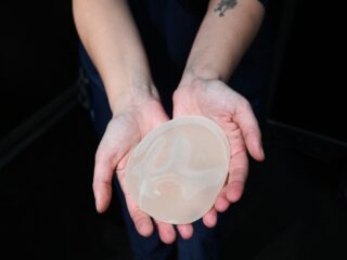 Breast Implant Illness: schuld ligt niet bij het siliconen borstimplantaat
