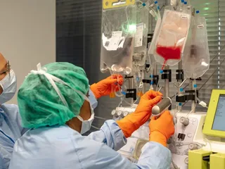 Wat is de potentie van CAR-Tceltherapie bij terugkerende beenmergkanker?