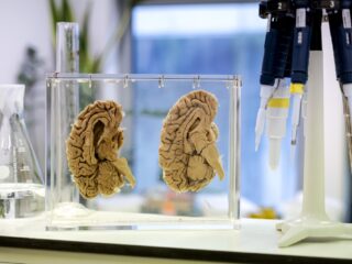 Alzheimer-onderzoek: 'Eerste signaal dat we er iets tegen kunnen doen, is er'