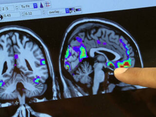 Wat gebeurt er in de hersenen van iemand die stemmen hoort?