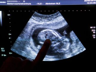 Een kinderwens? 'Denk op tijd aan je vruchtbaarheid'