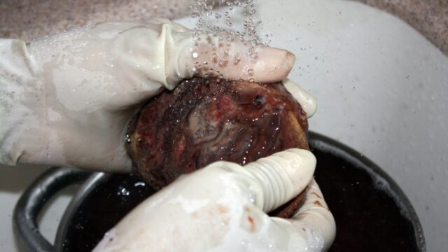 Het ondergeschoven kindje: de placenta