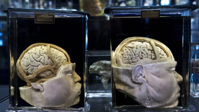 Medicijn tegen Alzheimer in aantocht: 'Bewijs dat het werkt is overweldigend'