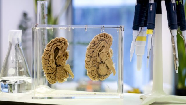 Kan het menselijk geheugen vol raken?