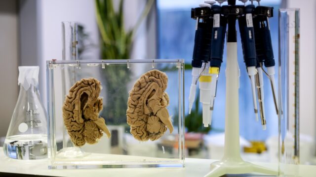 Nieuw instituut krijgt miljoenen van overheid om psychiatrische symptomen te onderzoeken