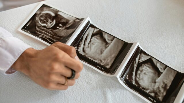 Kiezen voor het gezondste embryo; op weg naar designer baby's of onethisch om niet te doen?