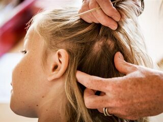 Tips om hoofdluis te voorkomen en bestrijden: 'Knuffels en kleding in de was niet nodig'