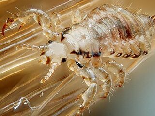 Tips om van je hoofdluis af te komen