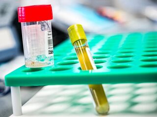 Coronavirus: vloek of zegen voor humor?