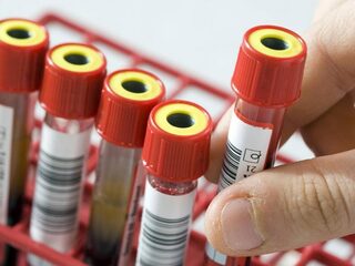 Eerste resultaten over opbouw immuniteit tegen corona komende weken verwacht