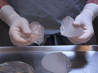 Onderzoek toont aan dat siliconen in borstimplantaten menselijke cellen doden