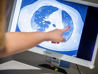 Pathologen zien meer dan alleen longontsteking bij overleden coronapatiënten