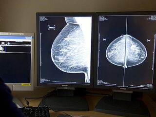 Aantal diagnoses van kanker neemt af: 'Wacht nu niet met naar de huisarts gaan'