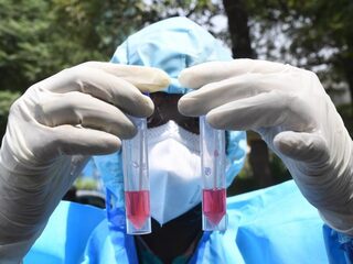 Hoe lang kennen we virussen al? '200 jaar geleden wisten we er nog niets vanaf'