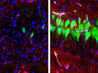 Fact check: kunnen dode hersenen echt weer actief worden?