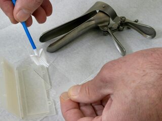 Vrouwen positief over bevolkingsonderzoek naar baarmoederhalskanker, maar deelname loopt terug