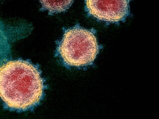 Britse variant coronavirus vastgesteld in regio Amsterdam