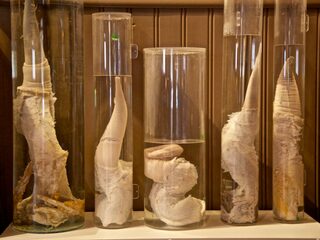 Deze lugubere musea bezorgen je gegarandeerd kippenvel