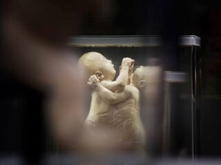 'Het is een baby waar ik naar kijk, maar er klopt iets niet aan'