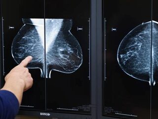 'Meeste mensen weten niet dat alcohol kans op kanker verhoogt'