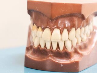 Hoogleraar trekt aan de bel: mondzorg bij kwetsbare ouderen vaak vergeten