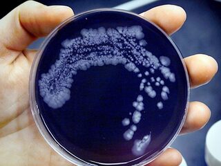 Gaan er straks meer mensen dood aan bacteriën dan aan kanker?