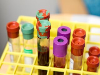 Een zeldzame ziekte én hiv