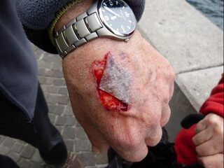 De naaktslak als inspiratiebron voor een superpleister