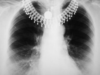 Voorwerpen direct van binnen bekijken met de FleX-ray scanner