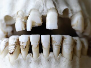 De evolutie van onze tanden: van schubben tot glazuur dat 'sterker is dan staal'