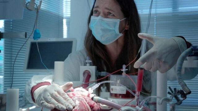Kunnen we het tekort aan organen oplossen met deze baanbrekende machine?