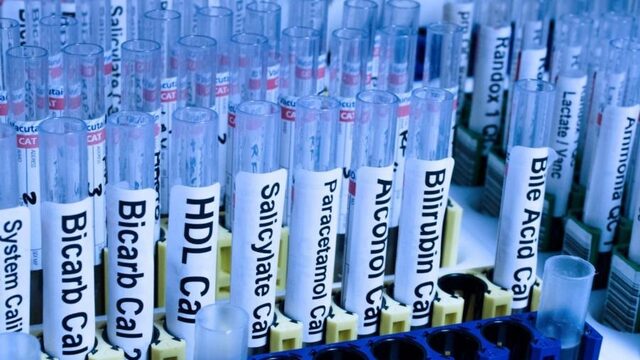 Aan het licht gebracht: Onze problematische relatie met de farmaceutische industrie