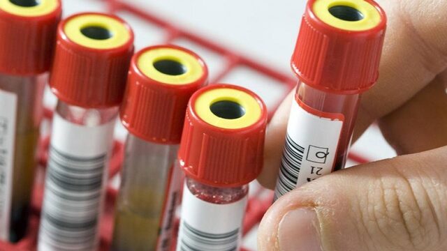 Eerste resultaten over opbouw immuniteit tegen corona komende weken verwacht