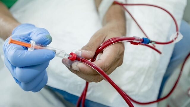 Waarom is een draagbare kunstnier zo moeilijk te ontwikkelen?