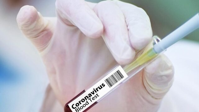 'We zijn dichter bij een vaccin dan we denken'