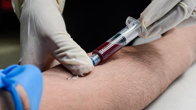Grote stappen richting genezing hiv