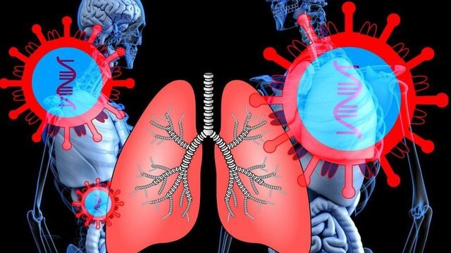 Levensbedreigende schimmel ontdekt bij kwart coronapatiënten op IC