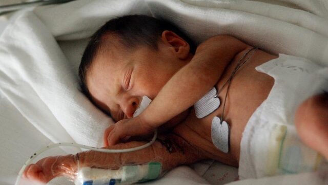 Jeroen Bosch ziekenhuis dringt aantal keizersnedes terug door teamwork