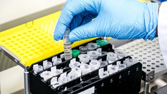 RIVM: aantal geregistreerde besmettingen naar 503