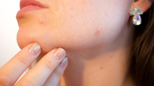 Zo krijg je een gezonde huid: 8 vragen en antwoorden