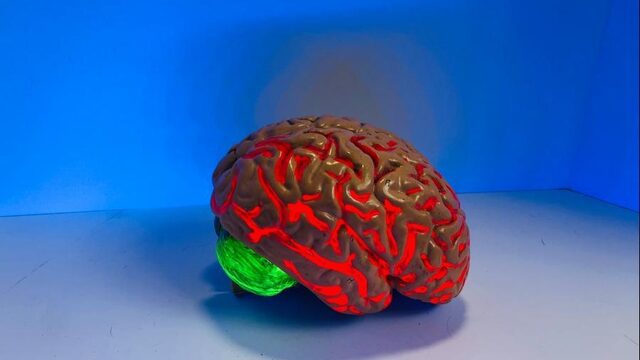 De misverstanden over migraine