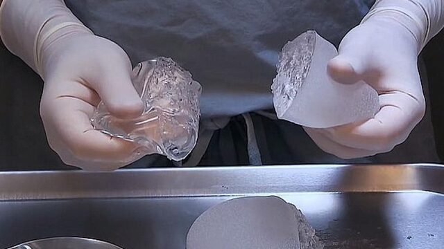 Onderzoek toont aan dat siliconen in borstimplantaten menselijke cellen doden
